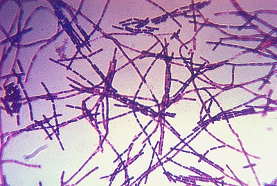 Foto på gramfärgade mjältbrandsbakterier.
