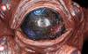 The eyes of Azathoth